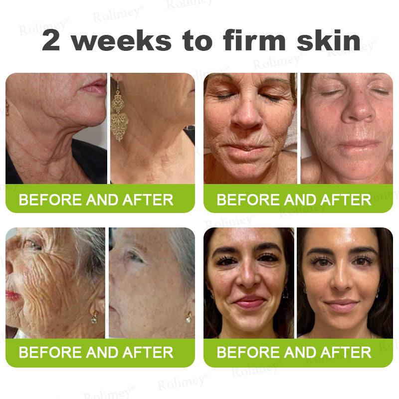 ✔Made and shipped from the USA 💫Rolimey® Botox & Vita-A Retinol Shot Wrinkle-Lift Tightening cream - Last Day Promotion 70% OFF