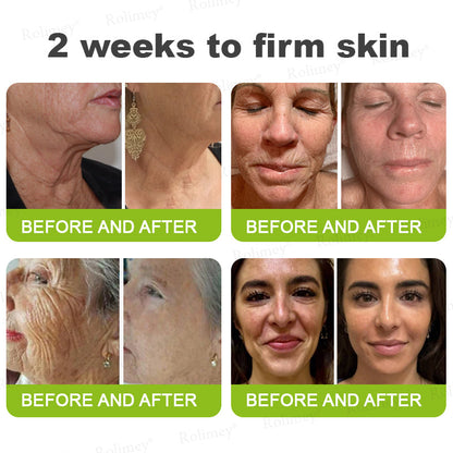 ✔Made and shipped from the USA 💫Rolimey® Botox & Vita-A Retinol Shot Wrinkle-Lift Tightening cream - Last Day Promotion 70% OFF