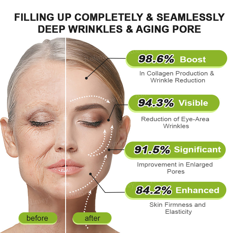✔Made and shipped from the USA 💫Rolimey® Botox & Vita-A Retinol Shot Wrinkle-Lift Tightening cream - Last Day Promotion 70% OFF