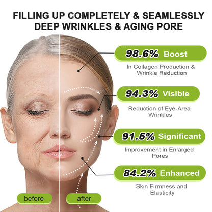 ✔Made and shipped from the USA 💫Rolimey® Botox & Vita-A Retinol Shot Wrinkle-Lift Tightening cream - Last Day Promotion 70% OFF