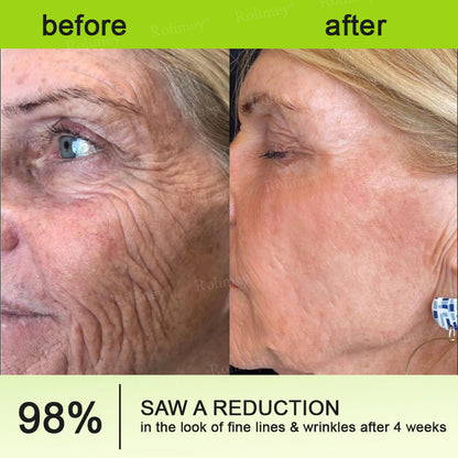 ✔Made and shipped from the USA 💫Rolimey® Botox & Vita-A Retinol Shot Wrinkle-Lift Tightening cream - Last Day Promotion 70% OFF
