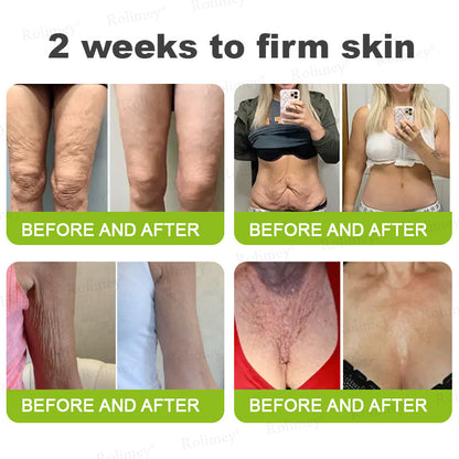 ✔Made and shipped from the USA 💫Rolimey® Botox & Vita-A Retinol Shot Wrinkle-Lift Tightening cream - Last Day Promotion 70% OFF